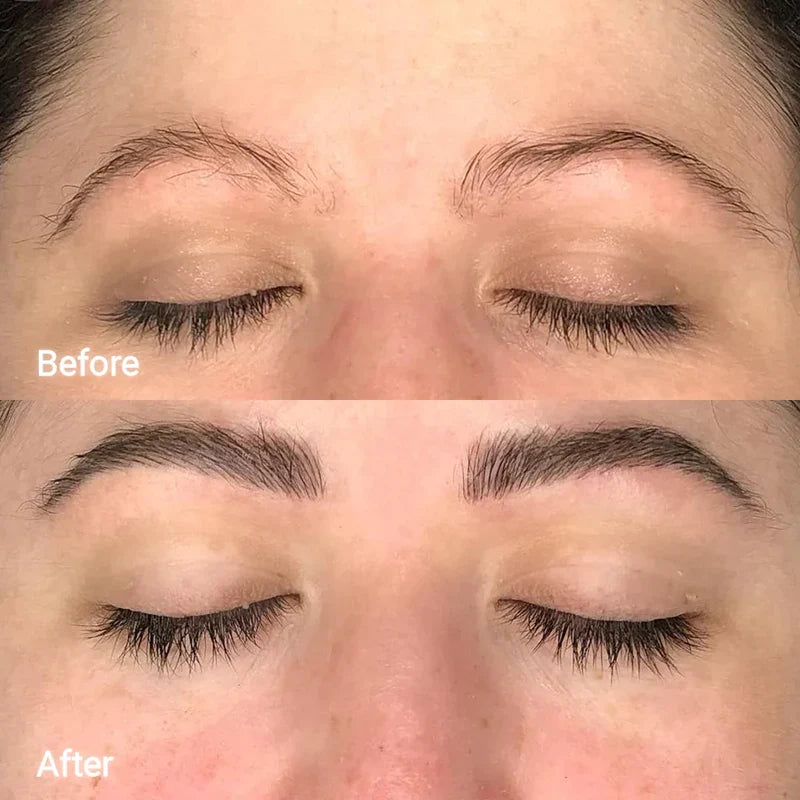 Lash and Brow Serum Set